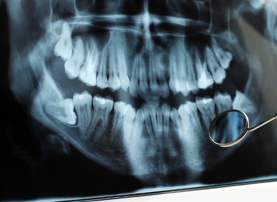 dental x ray mount waverley
