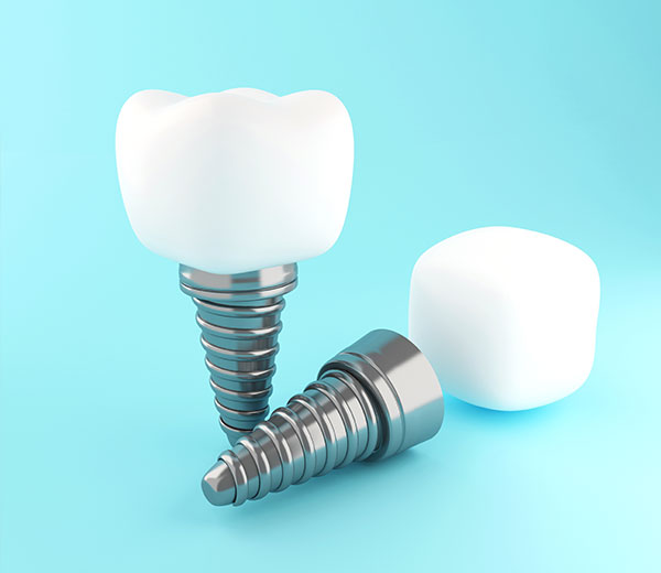 mount waverley dental crowns and implants