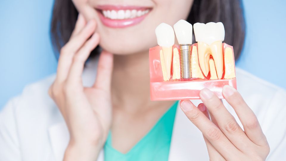 Dental Implant image blog